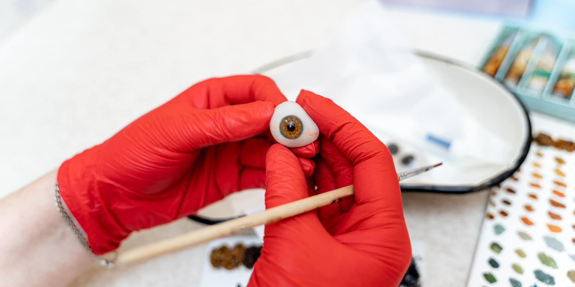 Orzuelo por Qu Aparece Y C mo Se Trata Blog De OftalmoSalud