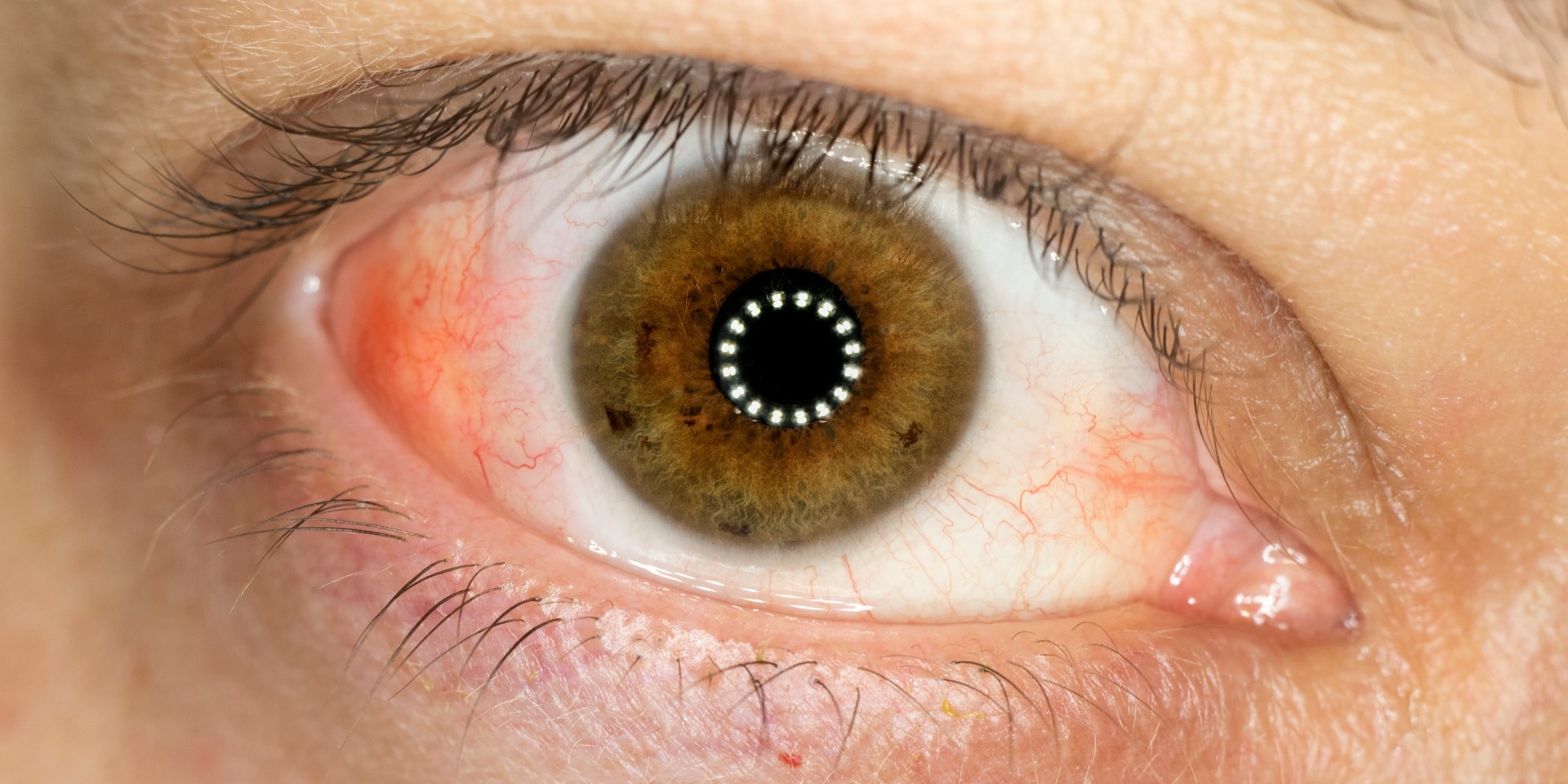 Cornea Funcion Archivos Blog De OftalmoSalud Cornea Funcion Archivos Blog De OftalmoSalud