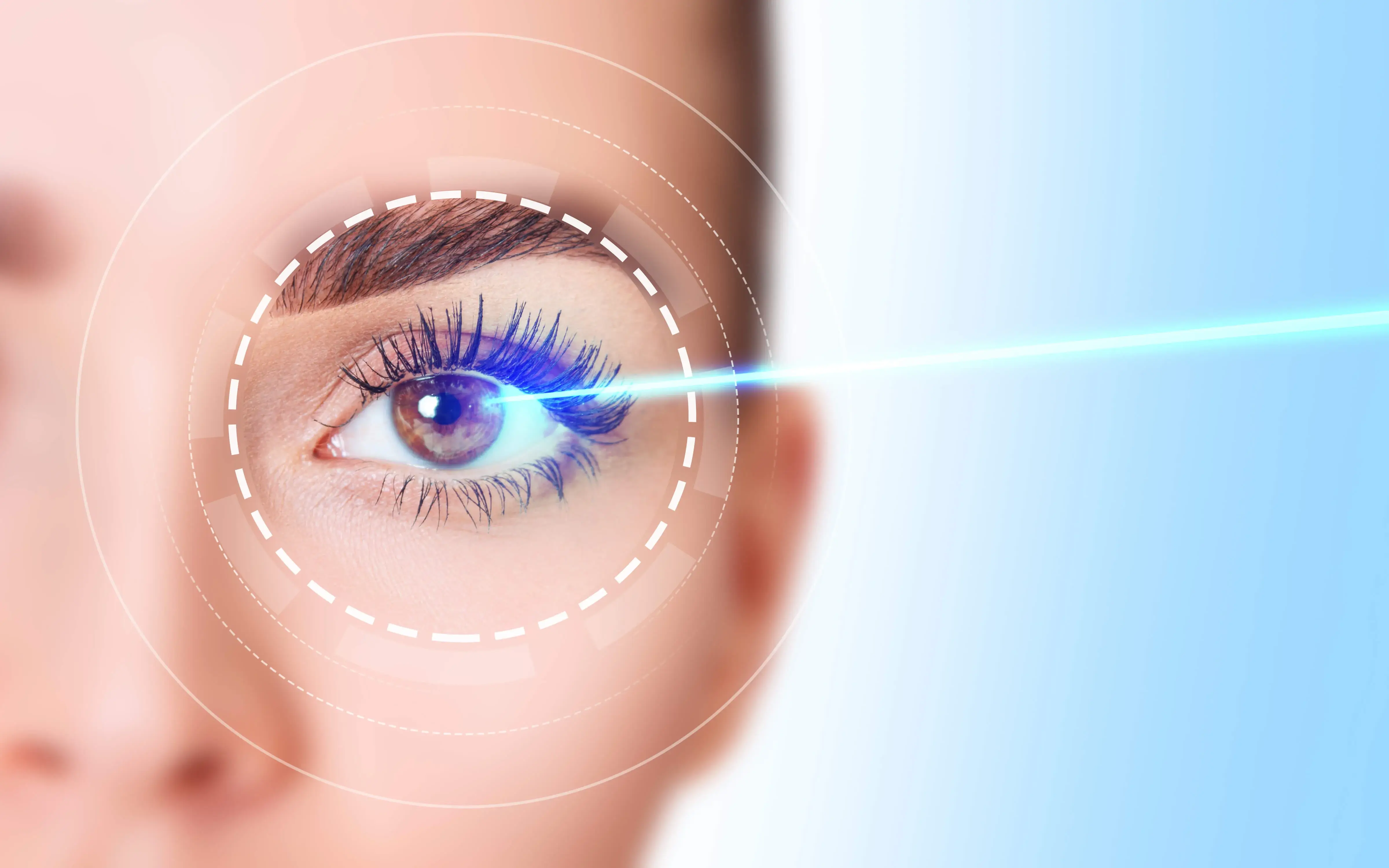 laser-ojos-cirugia-yag-laser-para-glaucoma-oftalmosalud