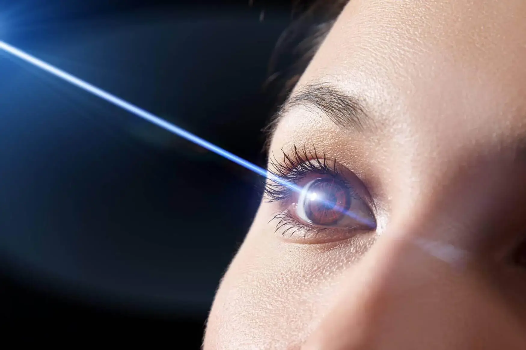 laser-para-el-tratamiento-de-glaucoma-iridotomia-laser-oftalmosalud