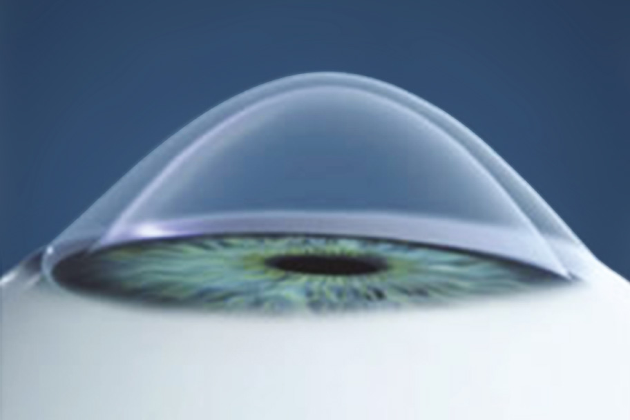 Especialidades Oftalmol gicas OftalmoSalud